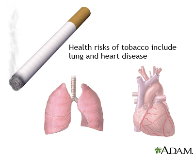 Tobacco health risks Tobacco health risks